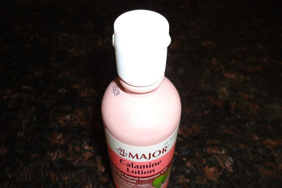 calamine lotion