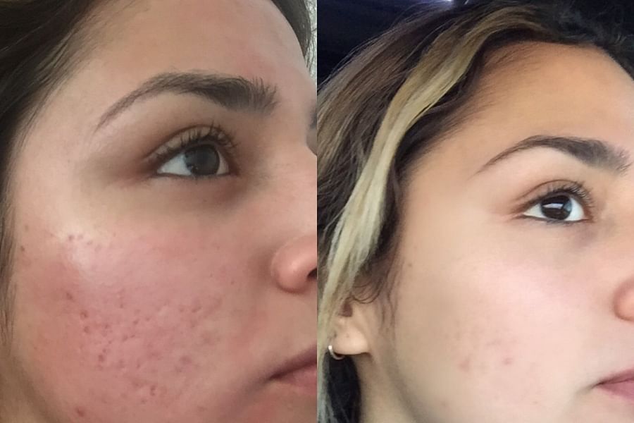 Royal Jelly Facial Serum